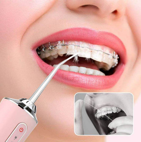 Portable Electric Scaler Three Modes Oral Cleaner - DMC Wholesale