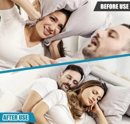 Anti-Snore Mouthpiece - Alt View