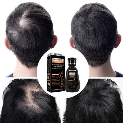 Anti Hair Loss Hair Growth Shampoo 250ml - DMC Wholesale